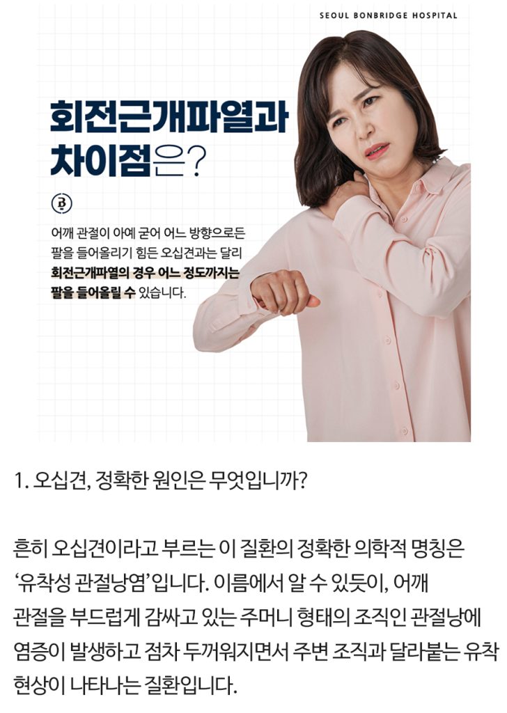 오십견 치료 방법 오십견치료방법 (3)