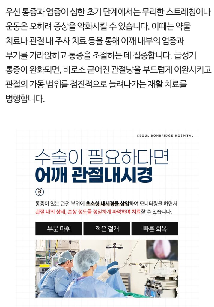 오십견 치료 방법 오십견치료방법 (8)